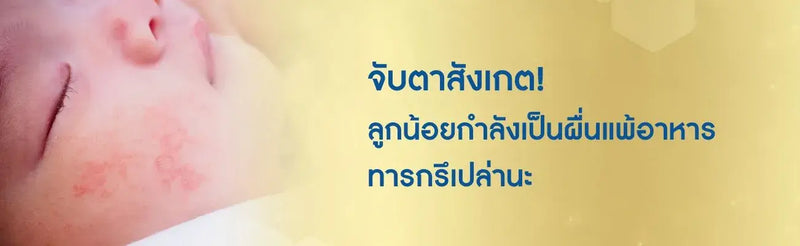 ผดผื่น ลักษณะผื่นแพ้อาหารทารก