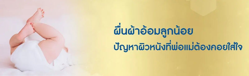 ผื่นผ้าอ้อม