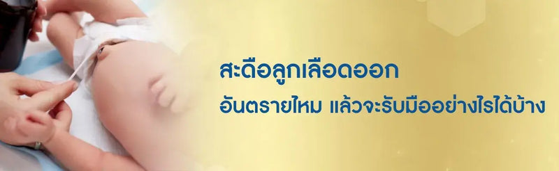 สะดือลูกเลือดออก อันตรายไหม แล้วจะรับมืออย่างไรได้บ้าง