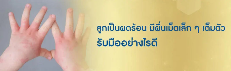 ลูกเป็นผื่นเม็ดเล็กๆ