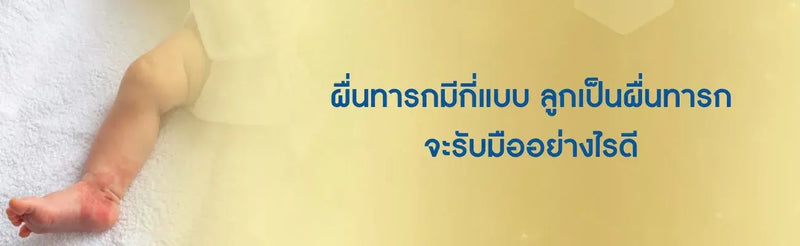 ผื่นทารกมีกี่แบบ
