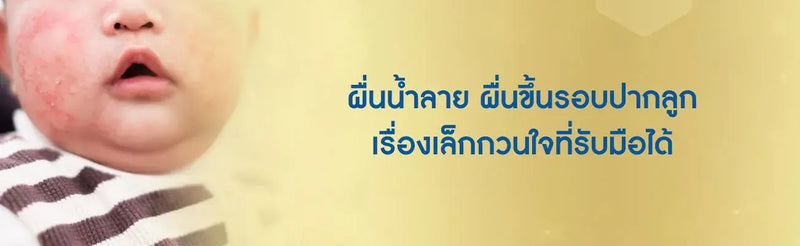 ผื่นน้ำลาย