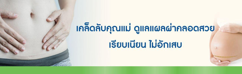 แผลผ่าคลอดสวย