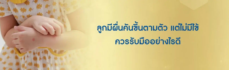 ลูกมีผื่นคันขึ้นตามตัว แต่ไม่มีไข้