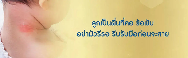 ลูกเป็นผื่นที่คอ ข้อพับ