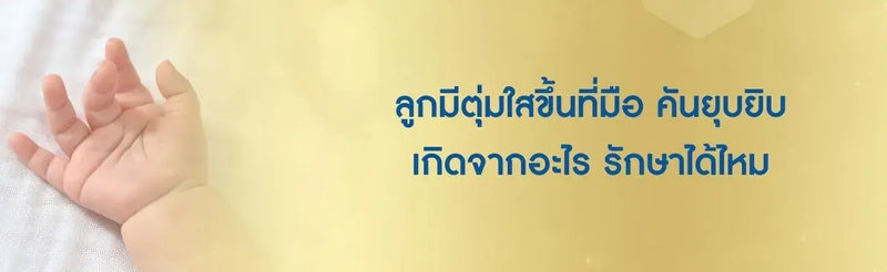 ลูกมีตุ่มใสขึ้นที่มือ คัน