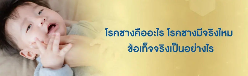 โรคซาง