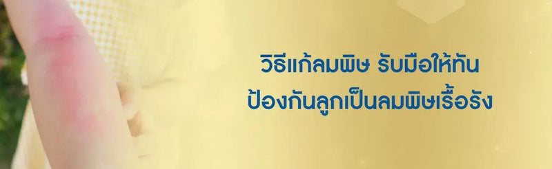 ลมพิษในเด็ก