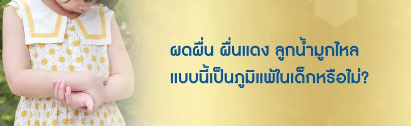 ผดผื่น ผื่นแดง ลูกน้ำมูกไหล แบบนี้เป็นภูมิแพ้ในเด็กหรือไม่