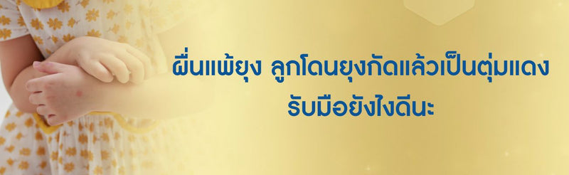 ผื่นแพ้ยุง