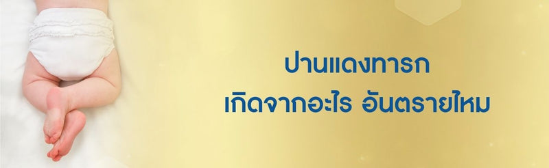 ปานแดงทารก