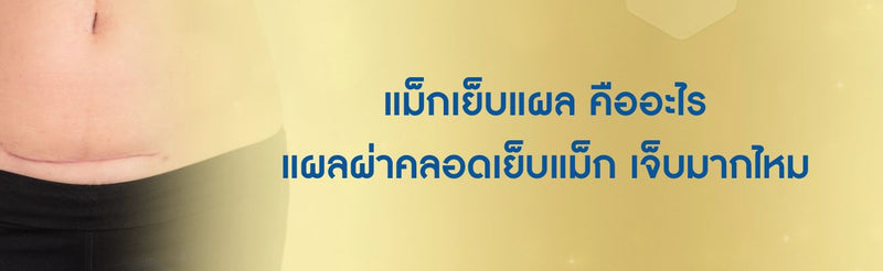 แผลผ่าคลอดเย็บแม็ก