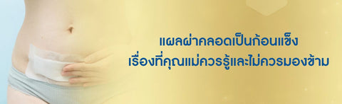 แผลผ่าคลอดเป็นก้อนแข็ง เรื่องที่คุณแม่ควรรู้และไม่ควรมองข้าม