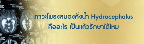 ภาวะโพรงสมองคั่งน้ำ Hydrocephalus คืออะไร เป็นแล้วรักษาได้ไหม