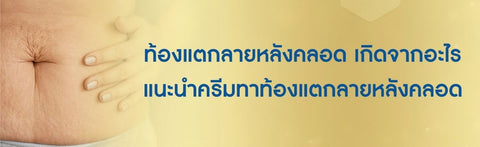 ท้องแตกลายหลังคลอด เกิดจากอะไร แนะนำครีมทาท้องแตกลายหลังคลอด