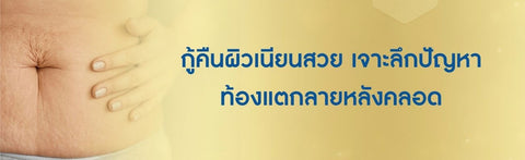 กู้คืนผิวเนียนสวย เจาะลึกปัญหา ท้องแตกลายหลังคลอด
